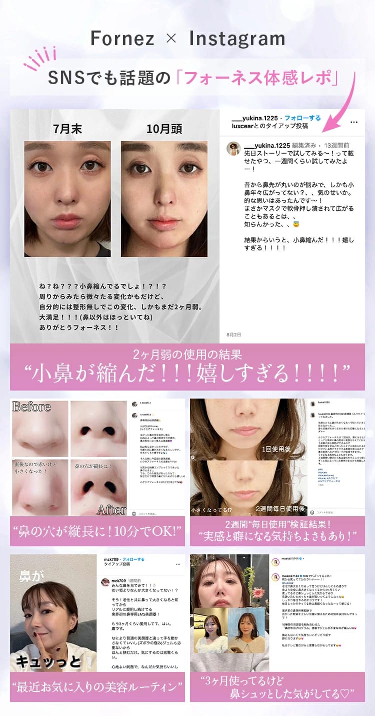 日本直送：LUXGEAR Fornez 鼻專用EMS美顏器 ✨ (充電式｜1台)(Z192)