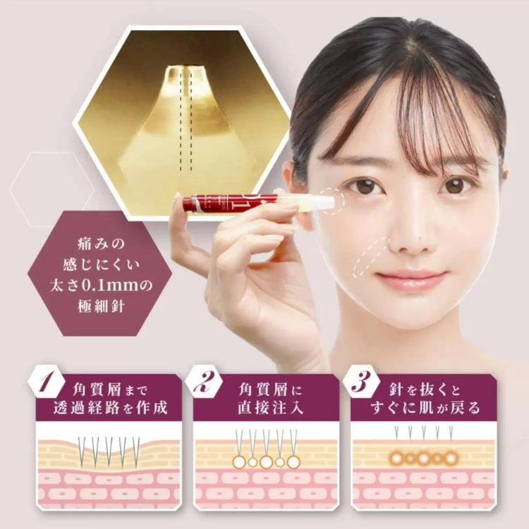 日本製：醫學級KIWAMI Spot Knock 0.1mm 微針注入美容液醫療器材廠製造・次世代 Retinol 注入 ⭐️（B3268）