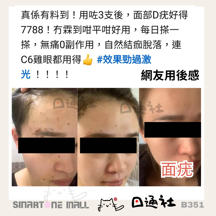 [Made in Japan]: Healthy Wart Removal Essence 10ml (B351)