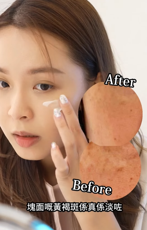 Made in Japan: Kracie | Shimiace Premium AX Medicated ACE Intensive Dark Spot Whitening Cream Advanced Formula (B3643)