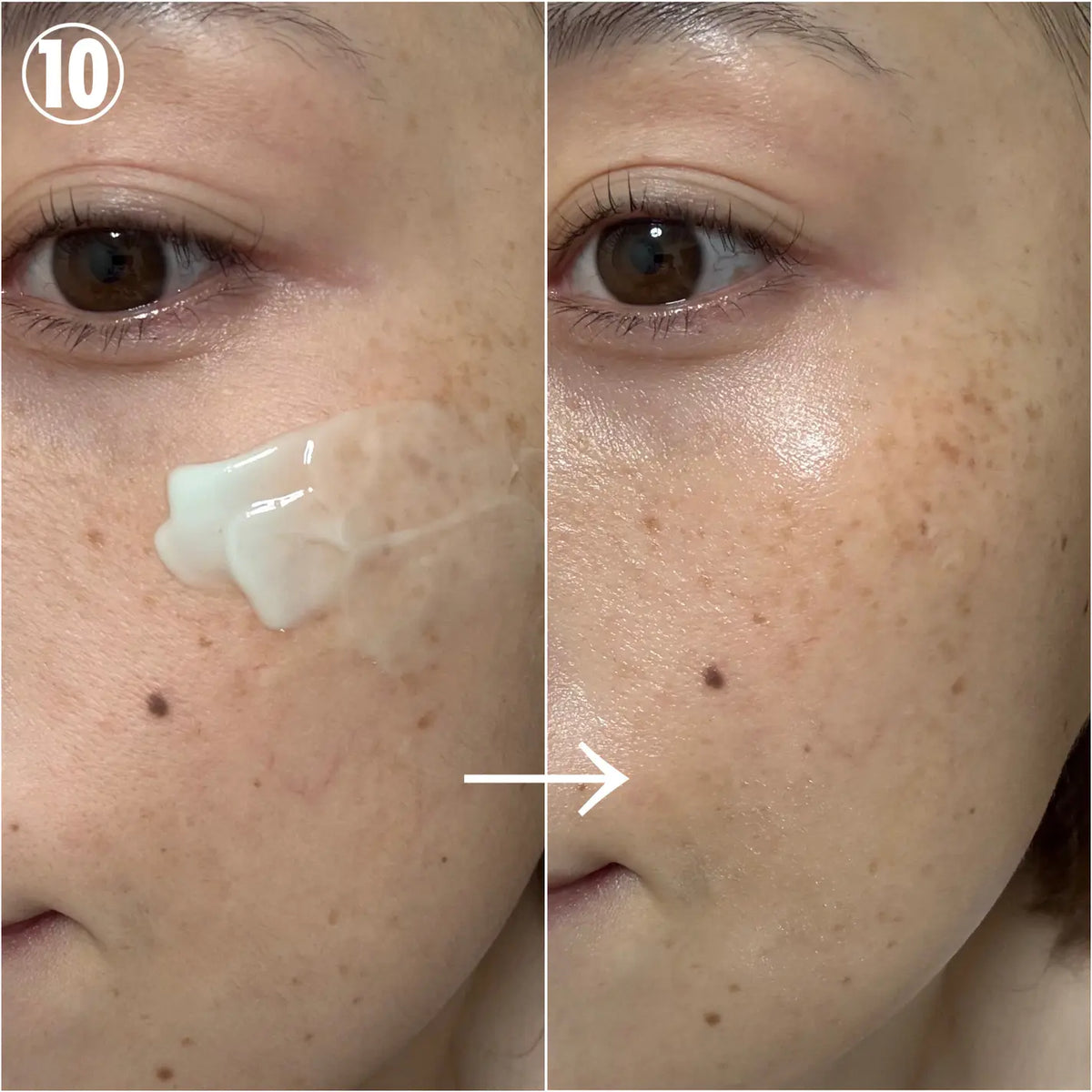 日本製：KATAN Cica Derma Needle Hit Serum 10 超强密集修護微針精華液 30g (B3314)