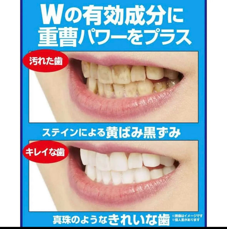 Made in Japan: JUSO Medicated Teeth Whitening Gel (B3006)