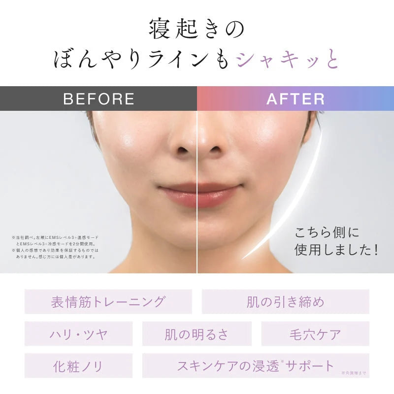 日本代購-NIPLUX代購-MEGURiS五合一EMS水冷溫感刮痧美顏儀TypeC充電款-日本進口NIPLUX雙向微電流提拉緊緻面部水冷收縮毛孔鎖骨頸部光療美容儀器-疏通面部水道排毒消腫-專業美妝美容家電照