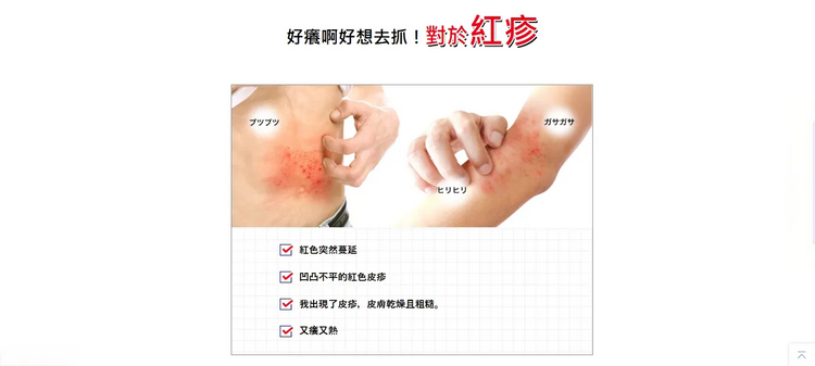 日本製：曼秀雷敦 皮炎・濕疹治療軟膏（藍色款）/乳霜型(紅色款) 8g (B3234)